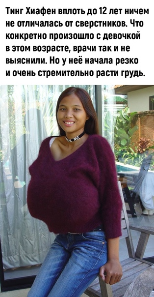 Китаянка Тинг Хиафен, которой сейчас 22 года, имеет самую большую и натуральную